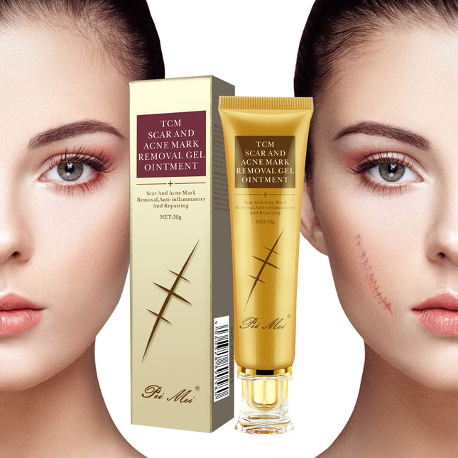 Scar And Acne Mark Removal Gel Ointment
